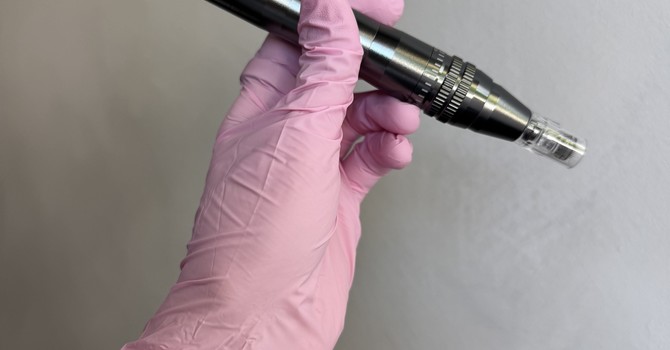 Micro needling with Exosomes 